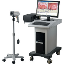 POY matériel médical gynécologique Colposcope Digital Imaging System
